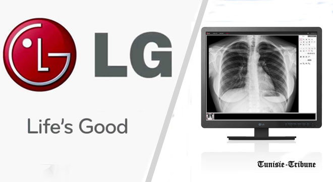 MEDICA 2017 : LG dévoile une gamme élargie de produits d’imagerie médicale