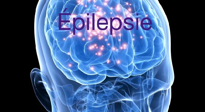 sante-la-7eme-journee-de-neurologie-de-monastir-se-tiendra-sur-les-epilepsies-focales