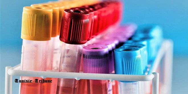 Vers un dépistage du cancer en 10 minutes ! Une méthode économique, pour détecter tous les types de cette maladie, est en expérimentation