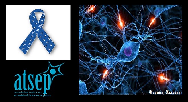 L’ATSEP lance un appel de soutien pour la Journée Mondiale de la Sclérose en Plaques (ce 15 juin)