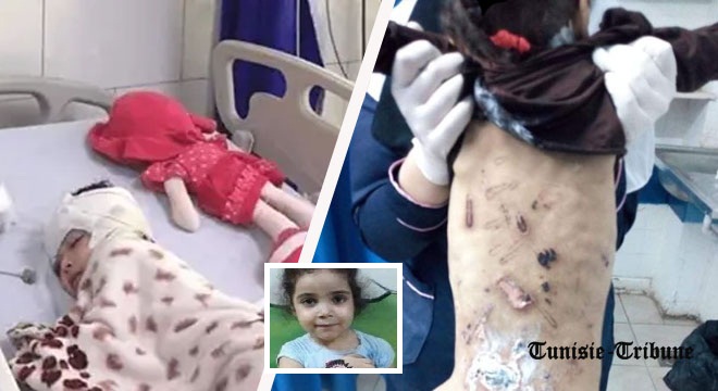 insoutenable-deces-dune-fillette-de-4-ans-apres-avoir-ete-violee-par-son-oncle-et-brulee-dans-ses-parties-intimes-par-sa-grand-mere-pour-masquer-le-crime03