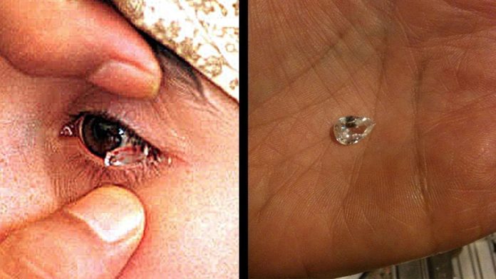 Une femme pleure des cristaux qui rendent les médecins perplexes (vidéo)