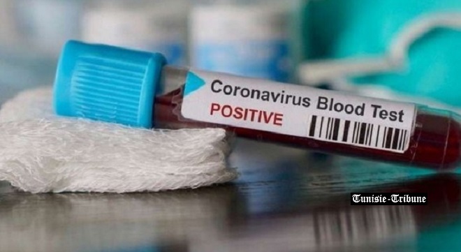 PREMIER DÉCÈS D’UN MÉDECIN INFECTÉ PAR CORONAVIRUS