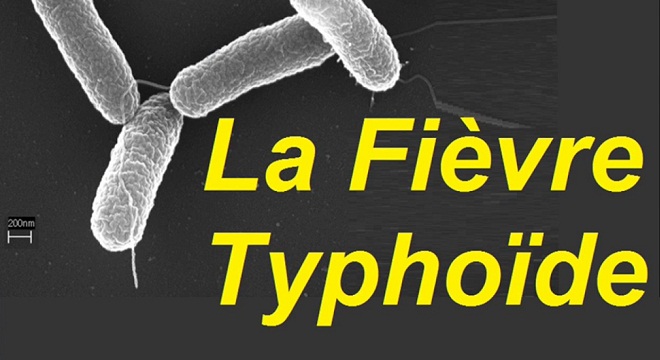 30-cas-de-fievre-typhoide-a-tataouine