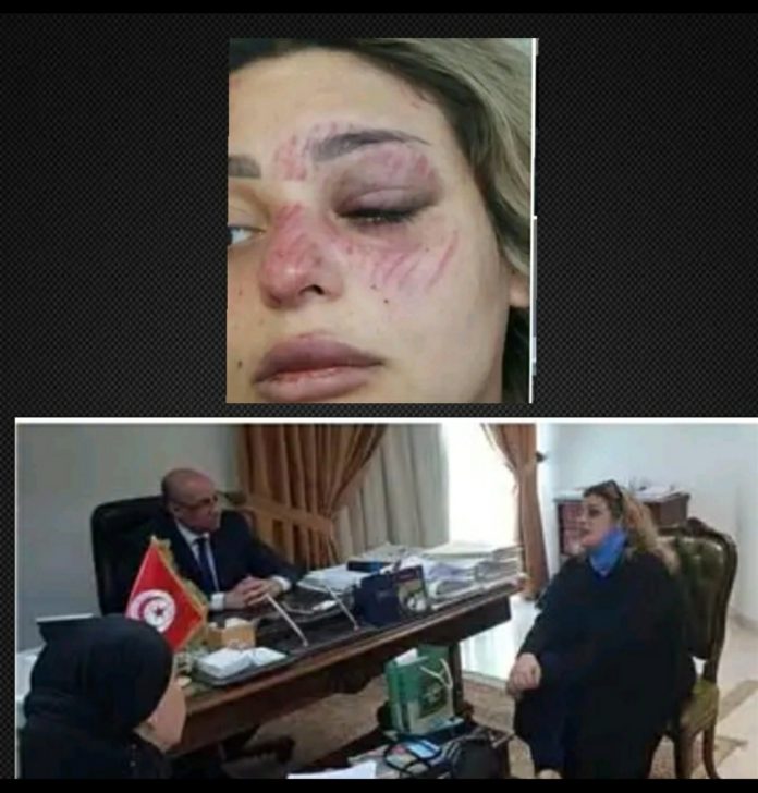 Tunisienne violentée par son ex-belle famille en Jordanie : L’ambassade de Tunisie à Amman entre en ligne