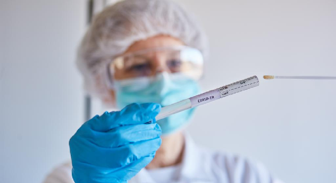 coronavirus-analyse04