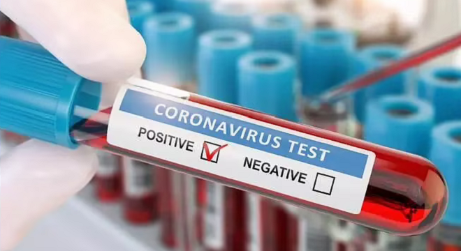 coronavirus-covid007