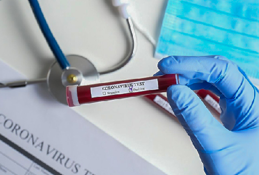 Nabeul : Coronavirus : 3 décès et 113 nouveaux cas