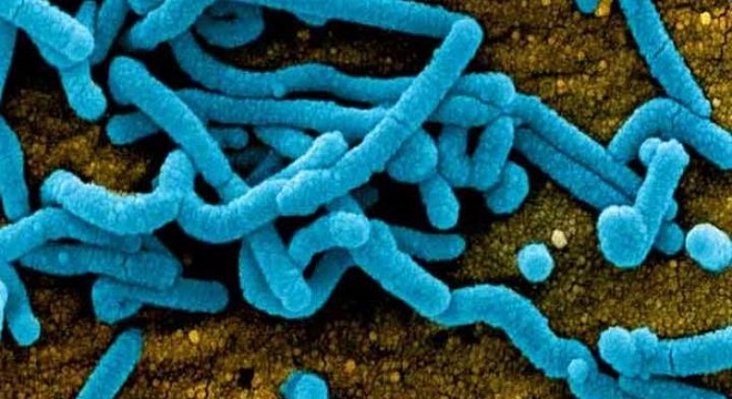 Sidi Bouzid: Un deuxième cas de shigellose confirmé