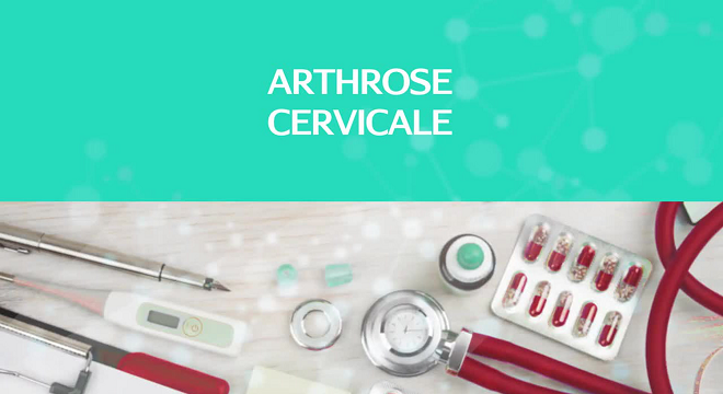 arthrose-cervicale-que-faire-contre-la-cervicarthrose