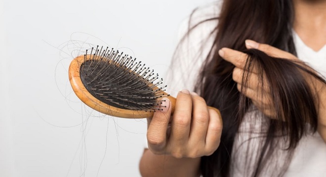 Combien de cheveux perdez-vous chaque jour