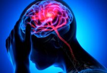 Comprendre et prévenir l’AVC : La Méthode Respiratoire Clé pour Protéger Votre Cerveau en 2 Minutes